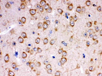 KChIP2/KCNIP2 Rabbit Polyclonal Antibody