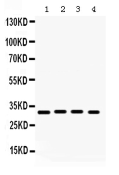 KChIP2/KCNIP2 Rabbit Polyclonal Antibody