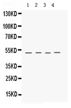 Keratocan Rabbit Polyclonal Antibody