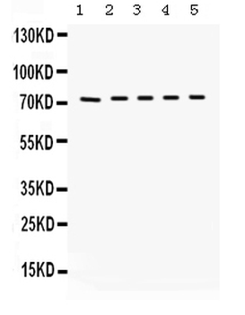 Kininogen 1/KNG1 Rabbit Polyclonal Antibody