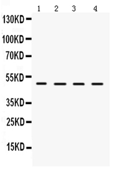 LCAT Rabbit Polyclonal Antibody