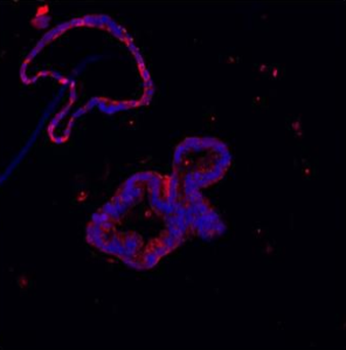 Lysozyme/LYZ Rabbit Polyclonal Antibody