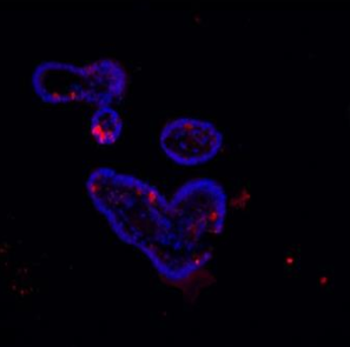 Lysozyme/LYZ Rabbit Polyclonal Antibody