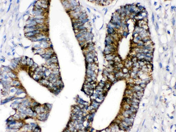 Monoamine Oxidase A/MAOA Rabbit Polyclonal Antibody