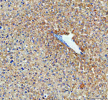 Monoamine Oxidase B/MAOB Rabbit Polyclonal Antibody