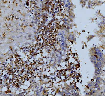 MMP9 Rabbit Polyclonal Antibody