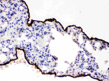 Mesothelin/MSLN Rabbit Polyclonal Antibody