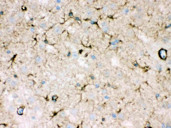 NDRG2 Rabbit Polyclonal Antibody