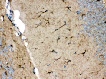 NDRG2 Rabbit Polyclonal Antibody