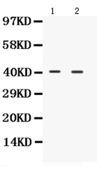 NDRG2 Rabbit Polyclonal Antibody