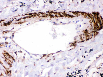 SHP2/PTPN11 Rabbit Polyclonal Antibody