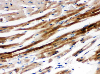 SHP2/PTPN11 Rabbit Polyclonal Antibody