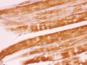 SHP2/PTPN11 Rabbit Polyclonal Antibody