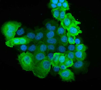 S100 alpha 6/S100A6 Rabbit Polyclonal Antibody