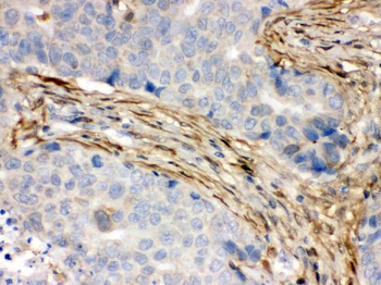 S100 alpha 6/S100A6 Rabbit Polyclonal Antibody