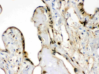 S100 alpha 6/S100A6 Rabbit Polyclonal Antibody