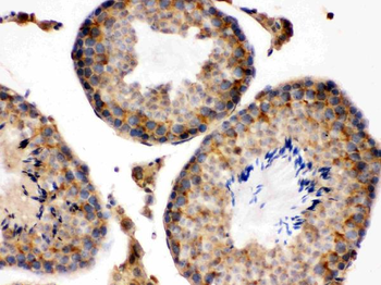 S100 alpha 6/S100A6 Rabbit Polyclonal Antibody