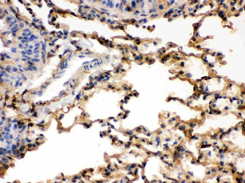 S100 alpha 6/S100A6 Rabbit Polyclonal Antibody
