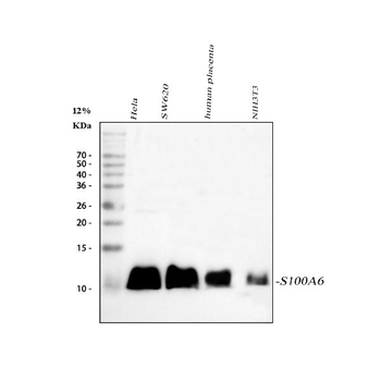 S100 alpha 6/S100A6 Rabbit Polyclonal Antibody