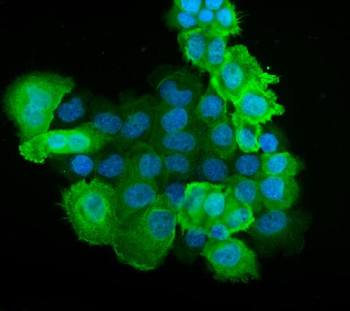 S100A9 Rabbit Polyclonal Antibody