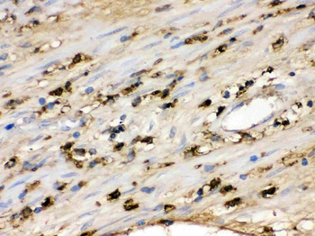 S100A9 Rabbit Polyclonal Antibody