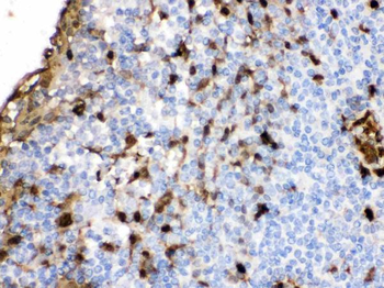 S100A9 Rabbit Polyclonal Antibody