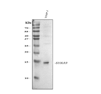 S100A9 Rabbit Polyclonal Antibody