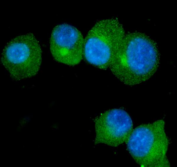 S100A9 Rabbit Polyclonal Antibody