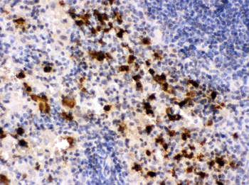 S100A9 Rabbit Polyclonal Antibody