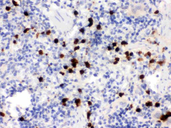 S100A9 Rabbit Polyclonal Antibody