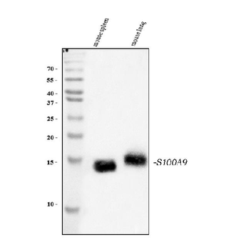 S100A9 Rabbit Polyclonal Antibody