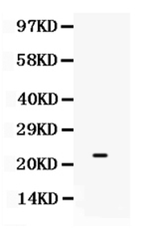 SECTM1/Sectm1b Rabbit Polyclonal Antibody