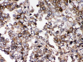 AIM2 Rabbit Polyclonal Antibody