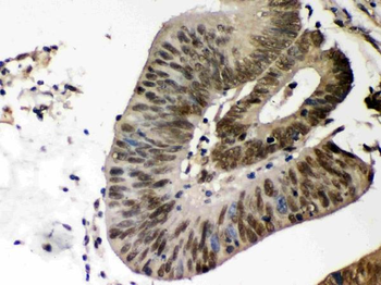 Caseine Kinase 1 alpha/CSNK1A1 Rabbit Polyclonal Antibody