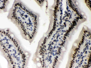 Caseine Kinase 1 alpha/CSNK1A1 Rabbit Polyclonal Antibody