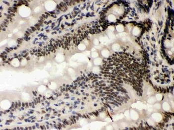 Caseine Kinase 1 alpha/CSNK1A1 Rabbit Polyclonal Antibody