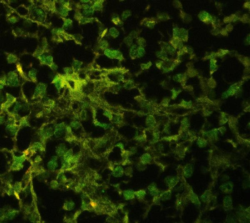 ELAVL4 Rabbit Polyclonal Antibody
