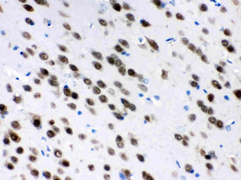 ELAVL4 Rabbit Polyclonal Antibody