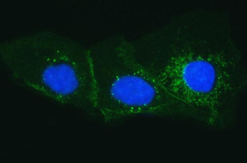 Tissue Factor/F3 Rabbit Polyclonal Antibody
