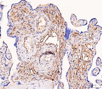 Tissue Factor/F3 Rabbit Polyclonal Antibody