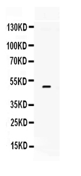 Tissue Factor/F3 Rabbit Polyclonal Antibody