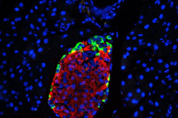 GLP1/GCG Rabbit Polyclonal Antibody