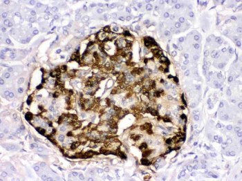 GLP1/GCG Rabbit Polyclonal Antibody