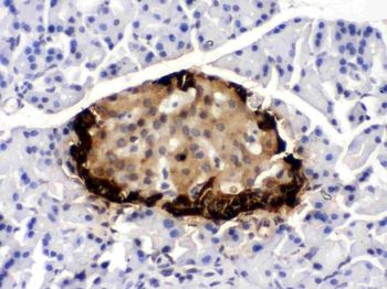 GLP1/GCG Rabbit Polyclonal Antibody