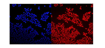 GNAQ Rabbit Polyclonal Antibody