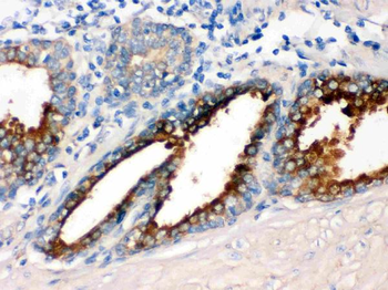 GNAQ Rabbit Polyclonal Antibody