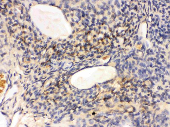 GNAQ Rabbit Polyclonal Antibody