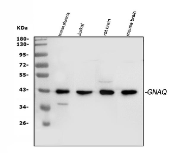 GNAQ Rabbit Polyclonal Antibody