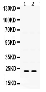 IGFBP5 Rabbit Polyclonal Antibody