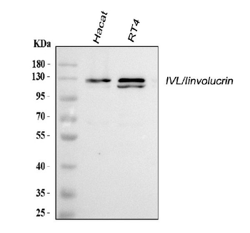 Involucrin/IVL Rabbit Polyclonal Antibody